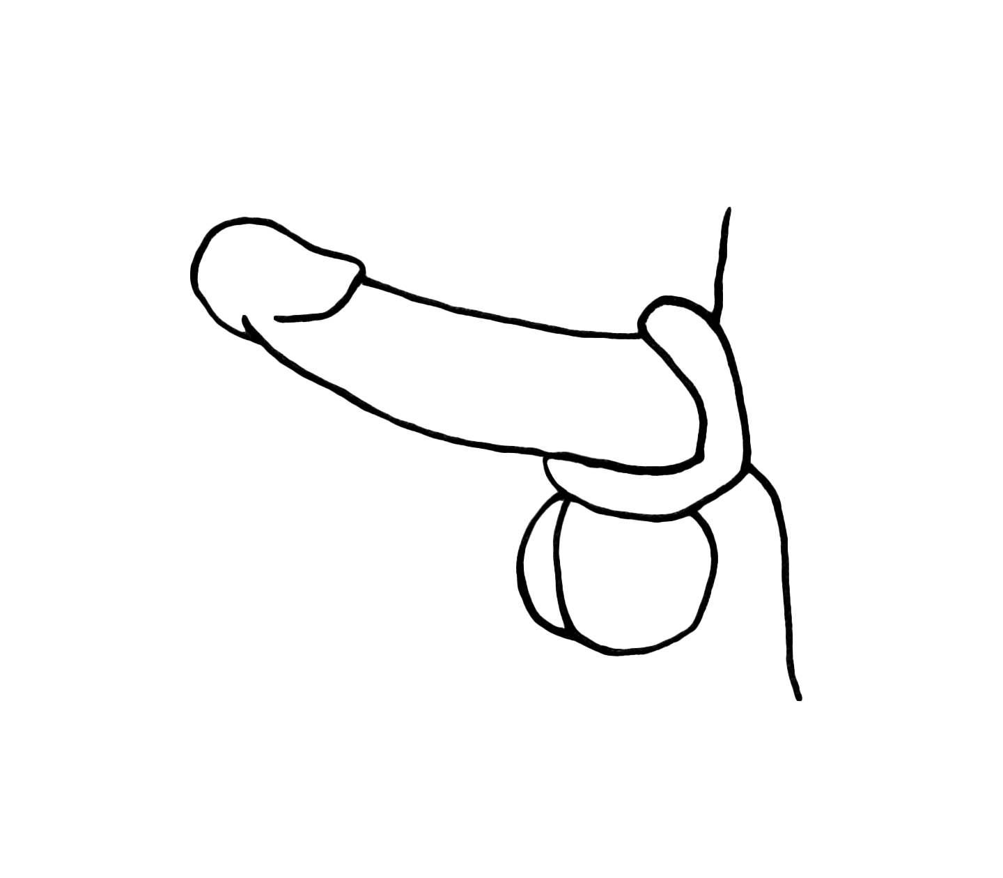 FIGURE 8 COCK RING